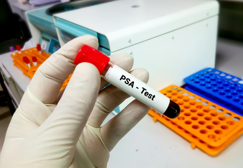 BPH (Enlarged Prostate)