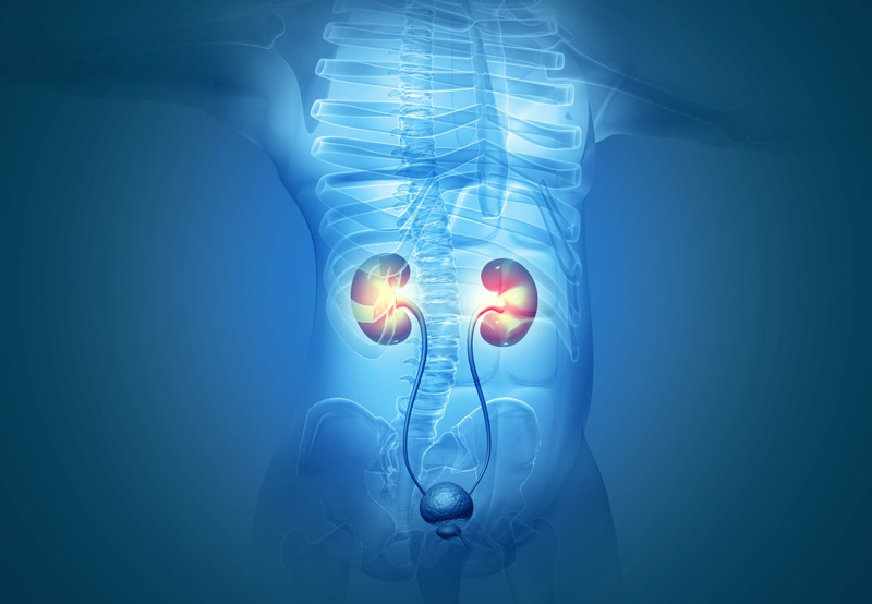 Ureteral Stricture