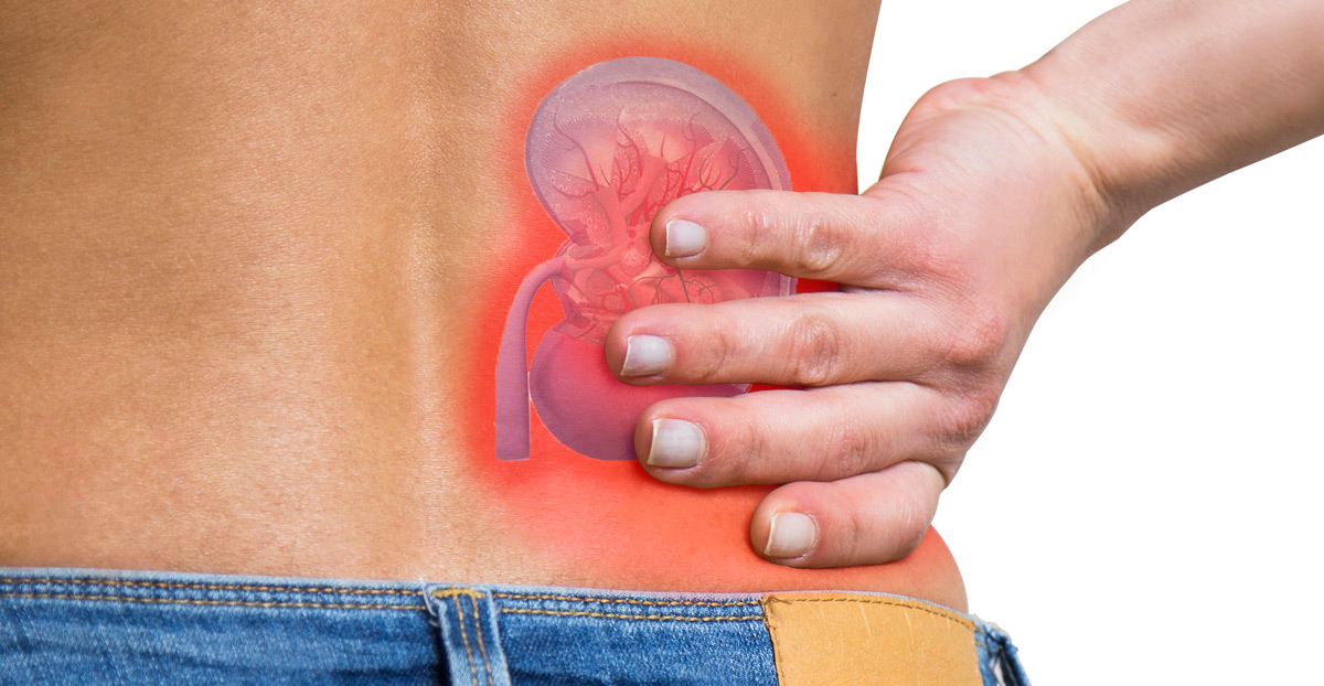 illustration-of-pain-from-kidney-stones illustration-of-pain-from-kidney-stones